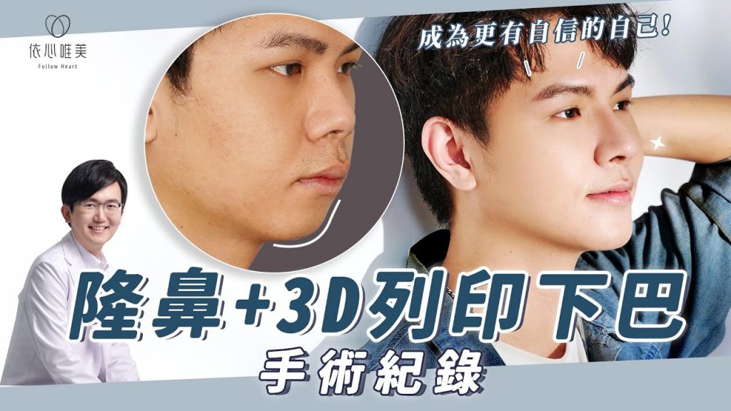 揮別容貌焦慮!踏出改變第一步🐾害羞小弟→甜帥歐巴♡ 結構式隆鼻 3D列印下巴手術|依心唯美 謝東穎醫師