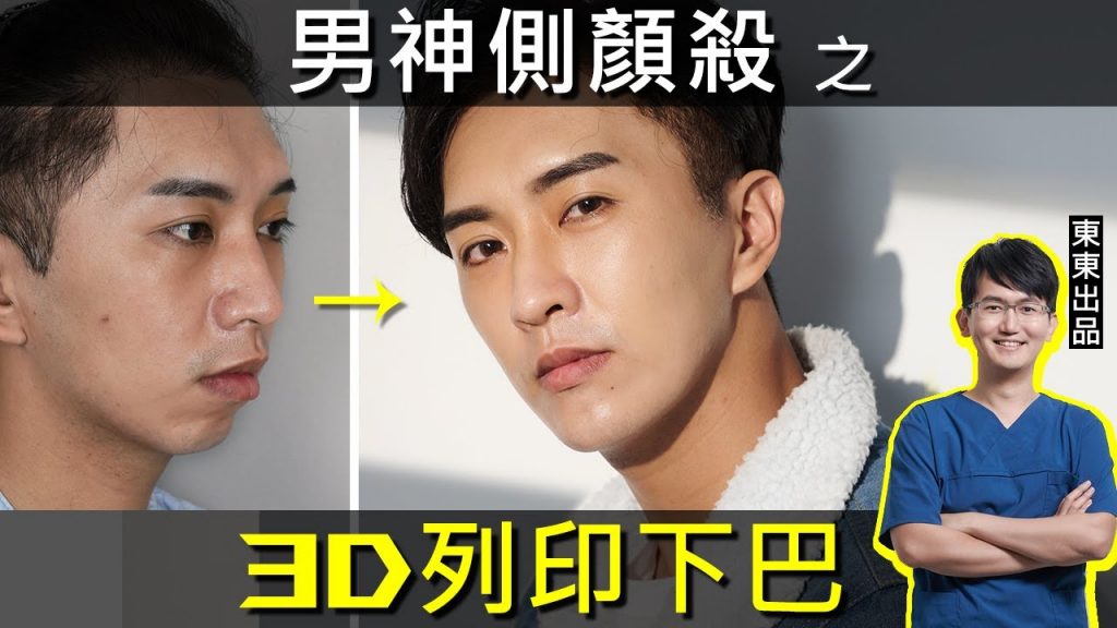 男神製造密技大公開!下巴後縮靠3D列印下巴解決!搭配蘋果肌臥蠶補脂 笑眼迷人|依心唯美 謝東穎醫師