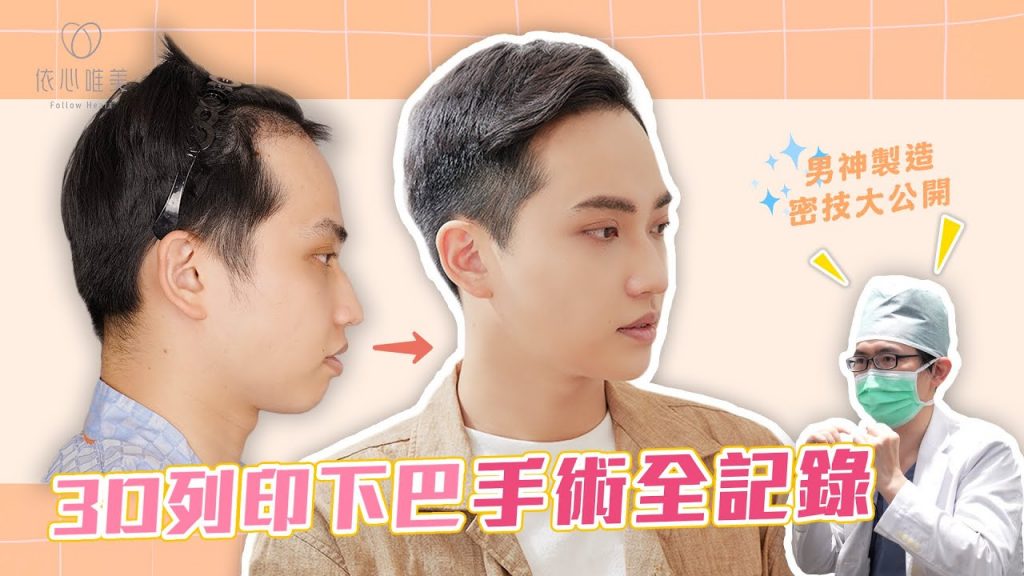 3D列印下巴讓你更俐落(客人術後胖了九公斤⋯)|依心唯美 謝東穎醫師