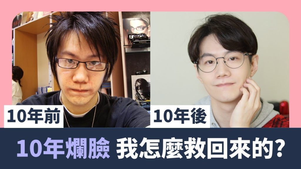 分享10年前為何爛臉? 皮膚怎麼恢復健康的?