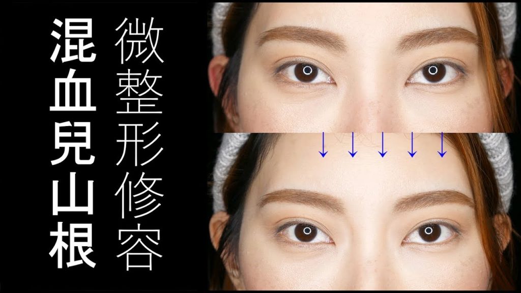 ●新手必看#23 混血兒山根打陰影是不夠的,還要___!微整形修容│Astor