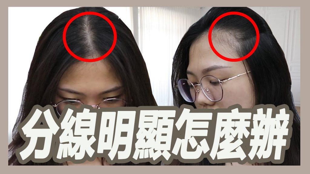 分線明顯該怎麼辦?阿彬的5種解決方法|揚棄|粘阿彬