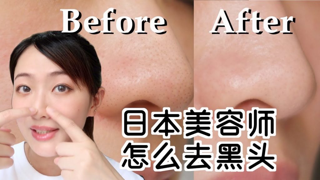 6分鐘告別草莓鼻 日本美容師教你正确去黑頭