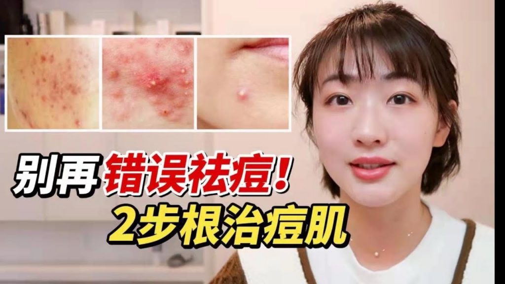 痘痘反復紅腫敏感?是你方法用錯了!內調外理全面根治痘痘肌!