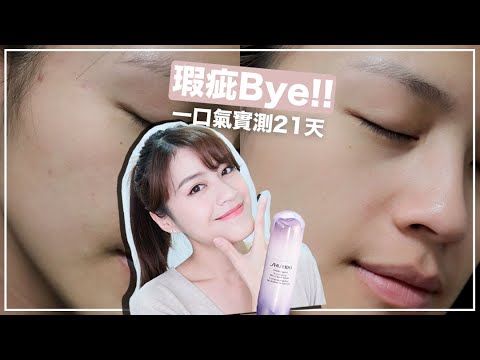 真的有亮欸~~~「資生堂 激透光亮白淡斑精華」7天有感實測