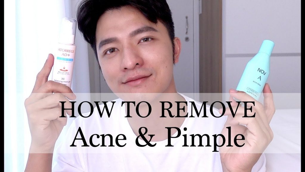 【凱咪最愛】抗痘超有感💕兩款凱咪最有感抗痘保養品‼️