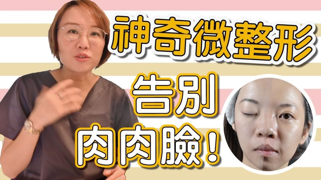 微整形之告別肉肉臉,你可以做哪一些微整形來改善你的臉形!