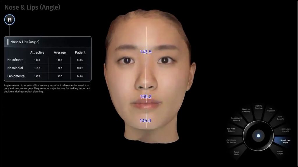 3D感測式相機術前測量輔助溝通- 台北,新竹,台南凡登整形外科