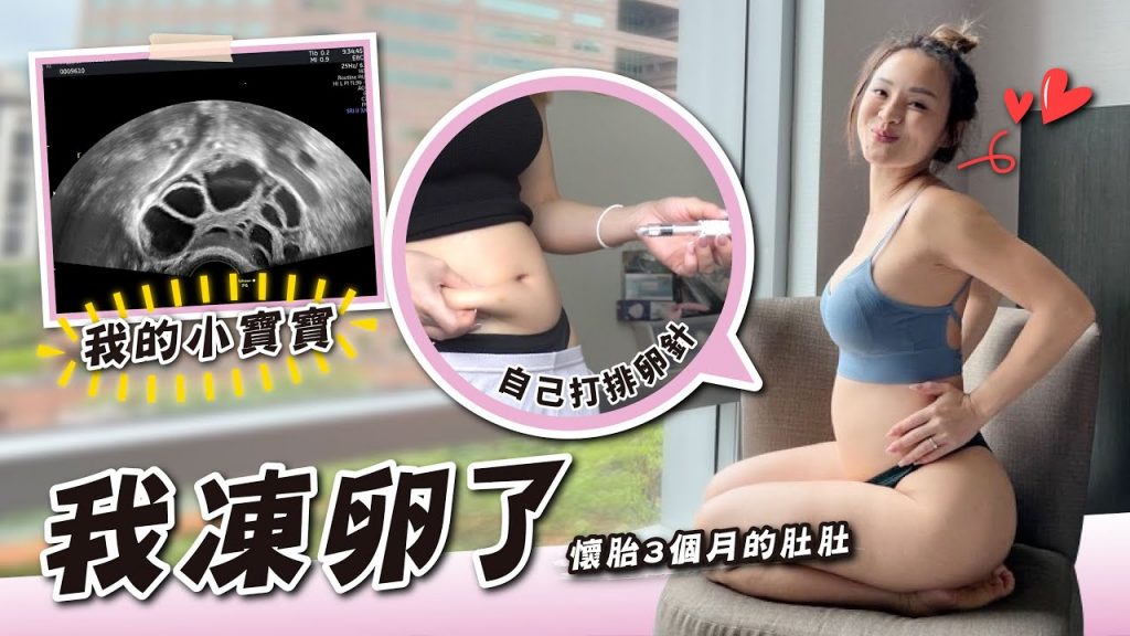 凍卵全記錄|妳需要凍卵嗎? | 我取出了XX顆卵 | VLOG#133