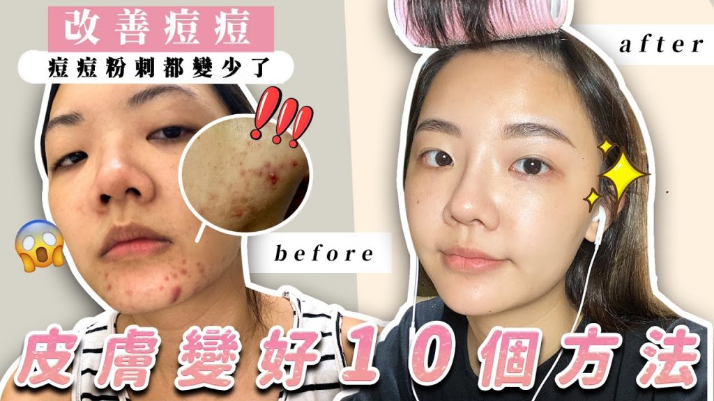 為什麼我皮膚變好了?讓皮膚變好的10個方法|福爾思庭