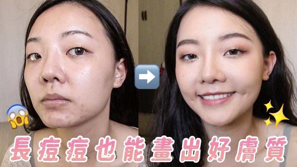 痘痘肌也能畫出超精緻的底妝|痘痘貼化妝|福爾思庭