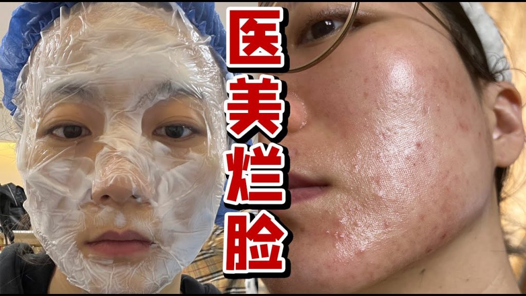 再也不乱做医美了!毁容式大烂脸?!我怕了!!