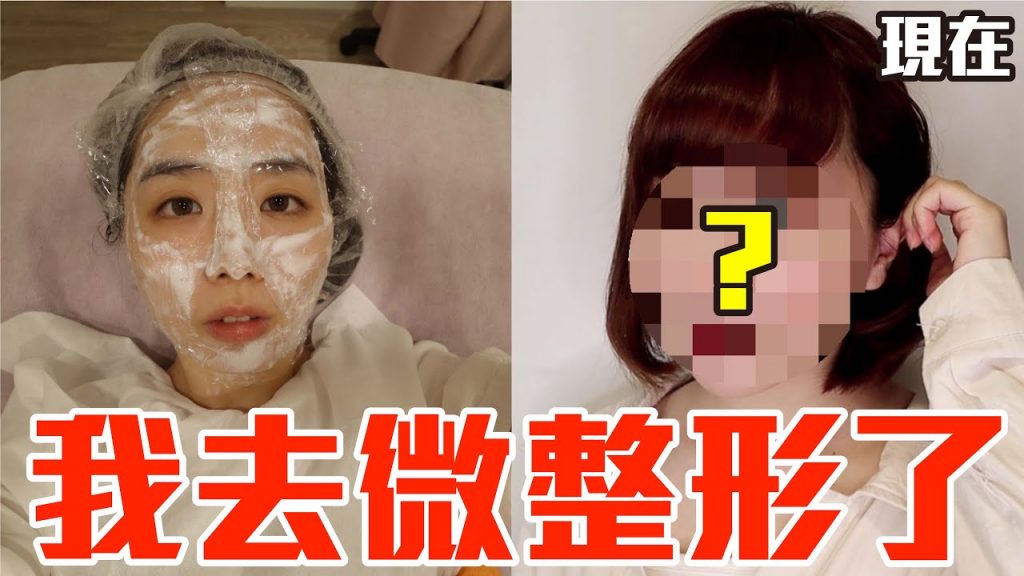 【Kiki】我決定去微整形了!一個月的真實過程全記錄!?
