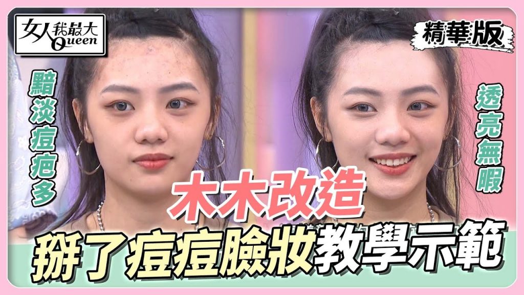 木木改造 瀏海造型狂長痘 「這樣做」跟痘痘說掰 女人我最大 20220912