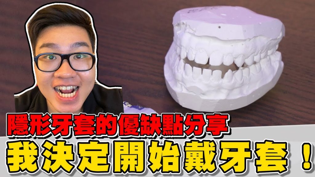 【Joeman】我決定開始戴牙套了!隱形牙套的優缺點分享