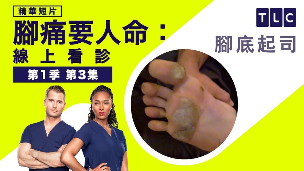 《腳痛要人命:線上看診》腳底刨起司,今晚我想來點帕瑪森起司|TLC 旅遊生活頻道