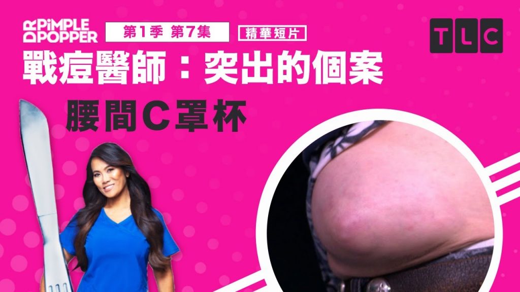 《戰痘醫師》C罩杯?乳頭?這到底是胸部還是腫瘤?|TLC 旅遊生活頻道