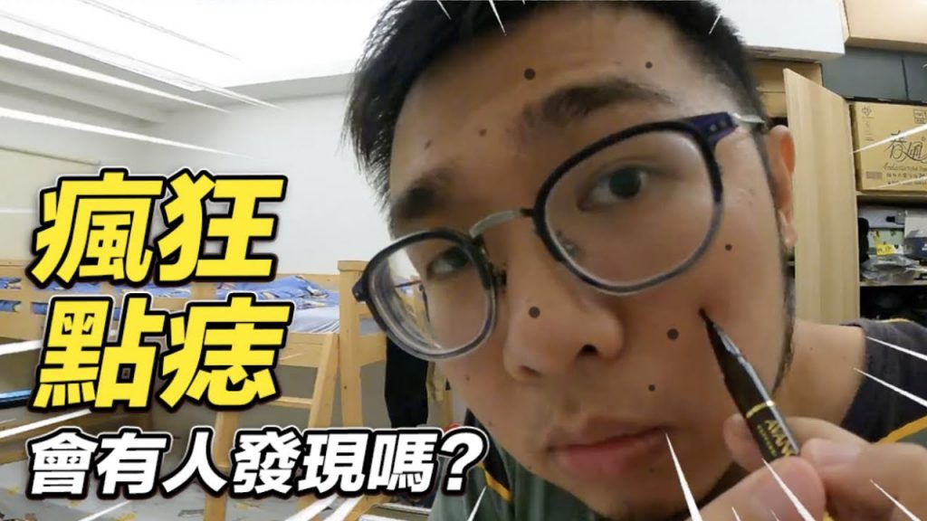 志銘與狸貓 【臉上的痣變多,會有人發現嗎?】志銘與狸貓