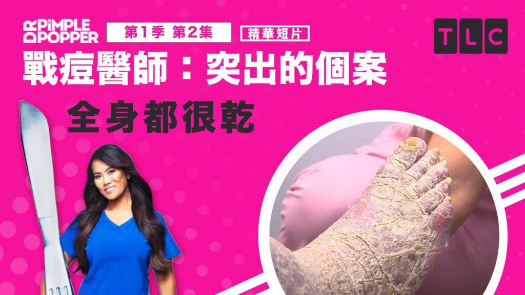 《戰痘醫師》乾乾乾乾乾乾乾,乾到不能再乾的皮膚|TLC 旅遊生活頻道
