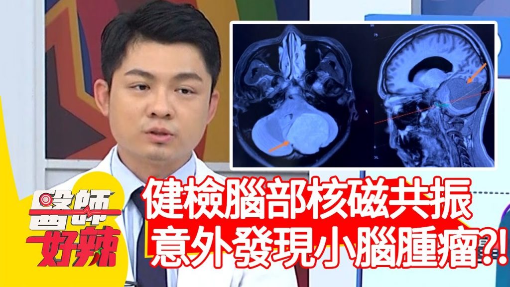 健檢腦部核磁共振,意外發現小腦腫瘤?!【#醫師好辣】20210503 part4 EP1142 宋明樺 洪素卿