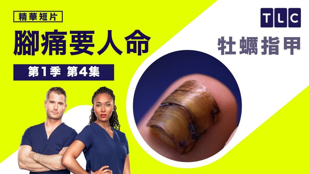 《腳痛要人命》你看是指甲,我看倒像是顆欠拔的牡蠣|TLC 旅遊生活頻道