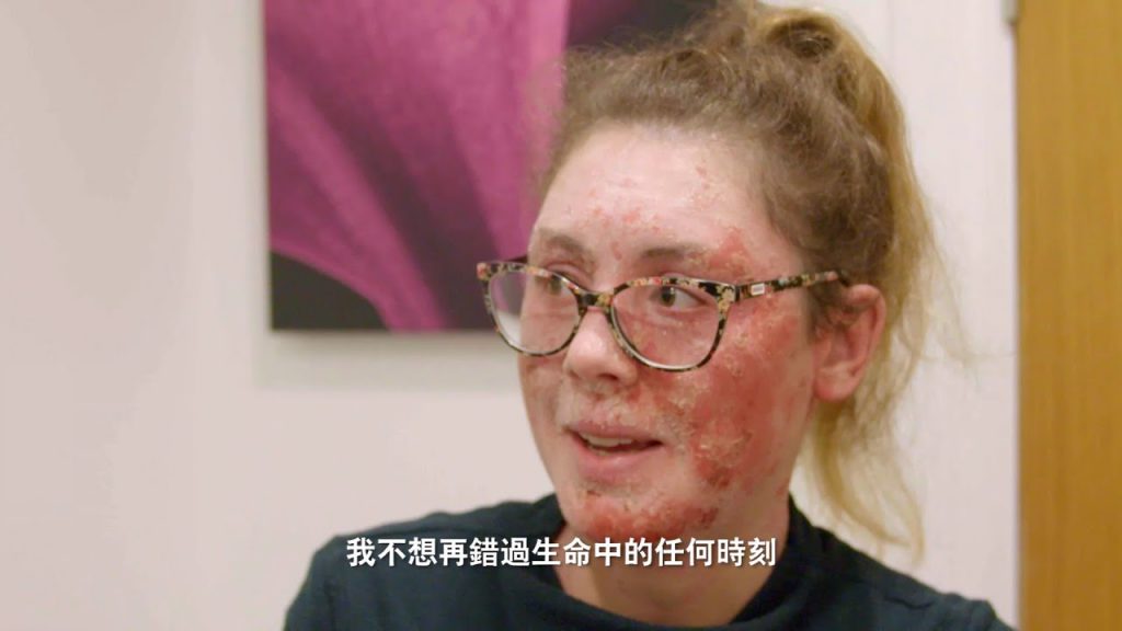 【安心觀賞版】皮膚科醫師如何挽救一個人的人生?接受治療的並不只是痘痘,還有自信|TLC 旅遊生活頻道