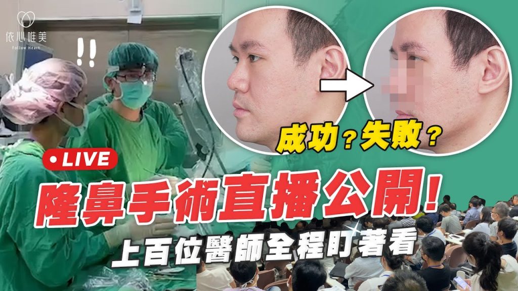 挫咧等!手術中途遭踢館?謝東穎醫師隆鼻示範教學! 美容醫學會一日vlog|依心唯美 謝東穎醫師
