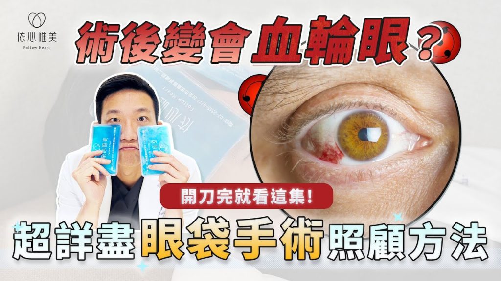 眼袋手術後遺症多?補脂該冰敷嗎?眼瞼外翻怎辦?眼袋術後就看這集|依心唯美 林子宇醫師