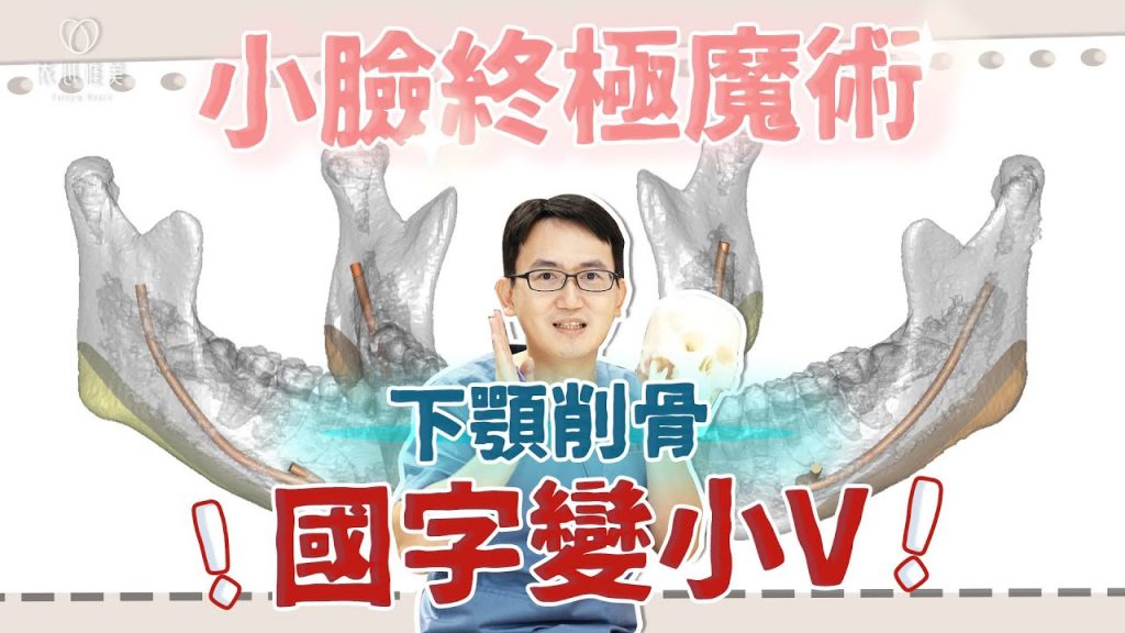 下削骨手術完整解析!哪些人做完下顎線更完美?削骨後遺症公開!|依心唯美 謝東穎醫師