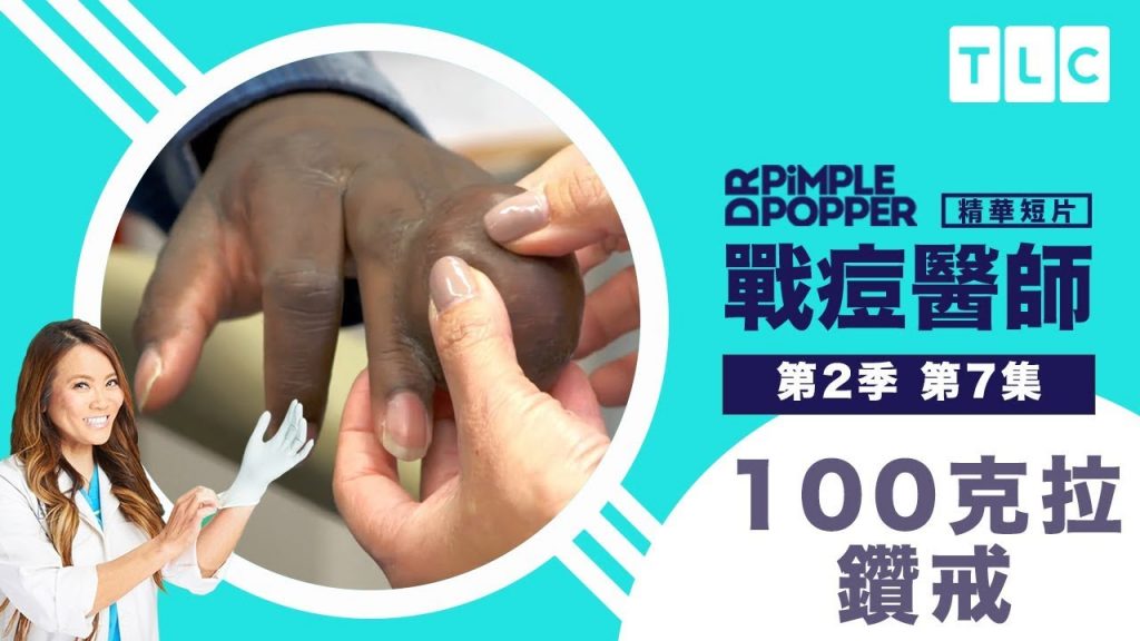 《戰痘醫師》自帶100克拉鑽戒?連醫師都沒看過|TLC 旅遊生活頻道