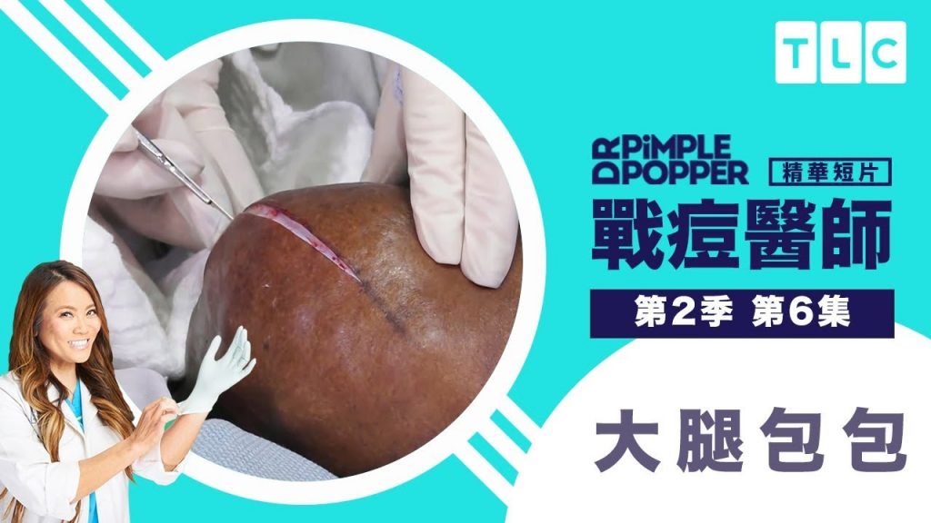 《戰痘醫師》良性腫瘤,惡性生活|TLC 旅遊生活頻道