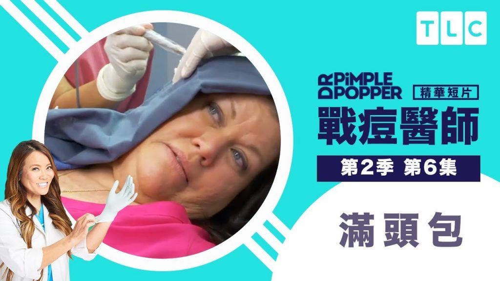 《戰痘醫師》囊腫七連發,你想要的款式通通有!|TLC 旅遊生活頻道