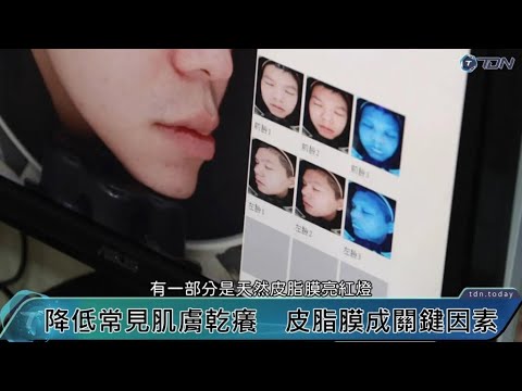 影/冬天肌膚乾燥脫皮易癢可能是「天然皮脂膜」亮紅燈【TDN新聞網】
