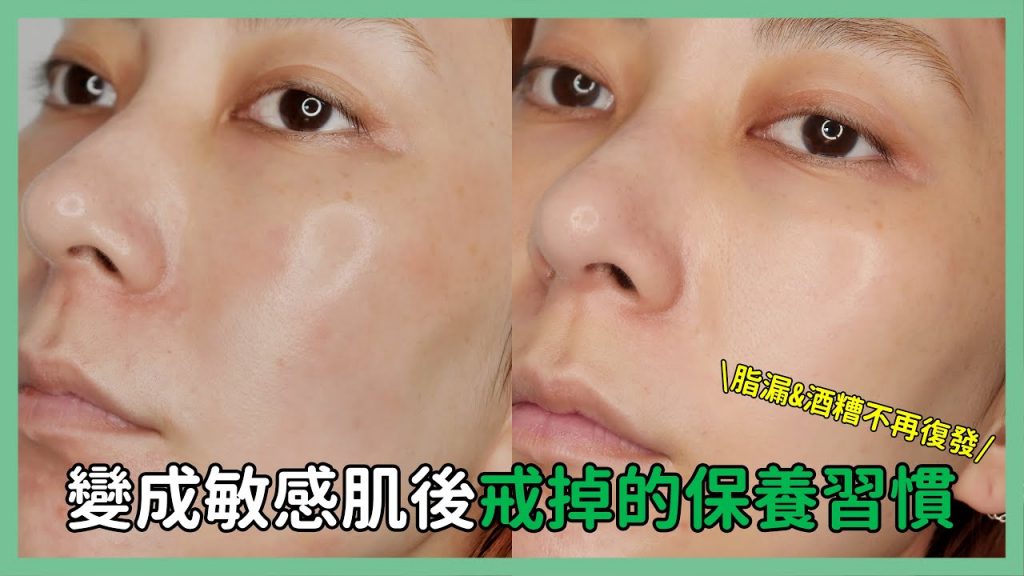 脂漏&酒糟不再復發《變成敏感肌後戒掉的保養習慣》|Astor