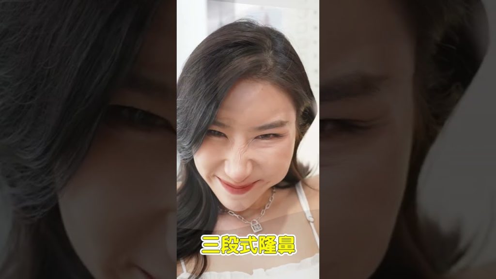 三段式自然系鼻整形隆鼻 Dr.朱立箴醫師