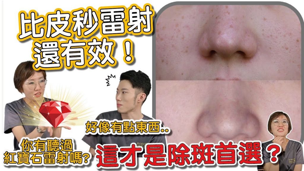 跟臉上斑點說掰掰!皮膚科醫生愛用的除斑雷射:紅寶石雷射!