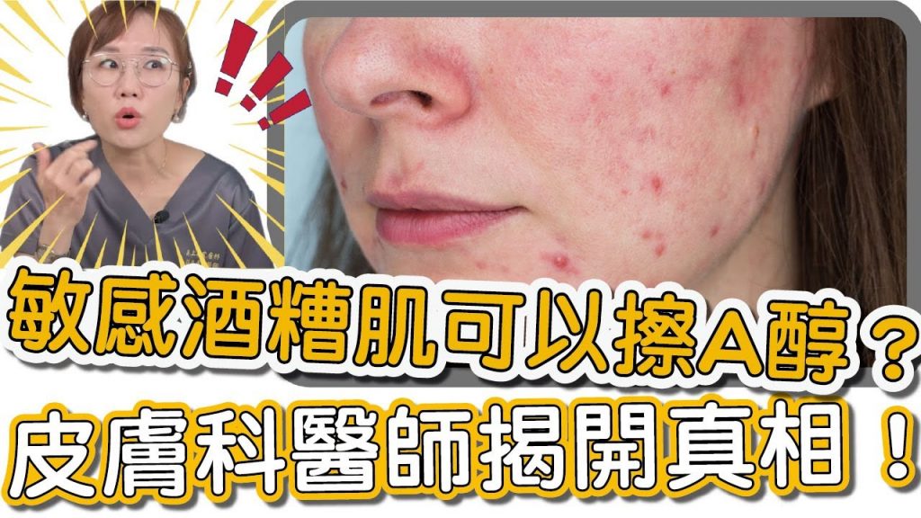 酒糟性肌膚真的能用使用A醇護膚嗎?皮膚科專科醫師莊盈彥來跟你說明!