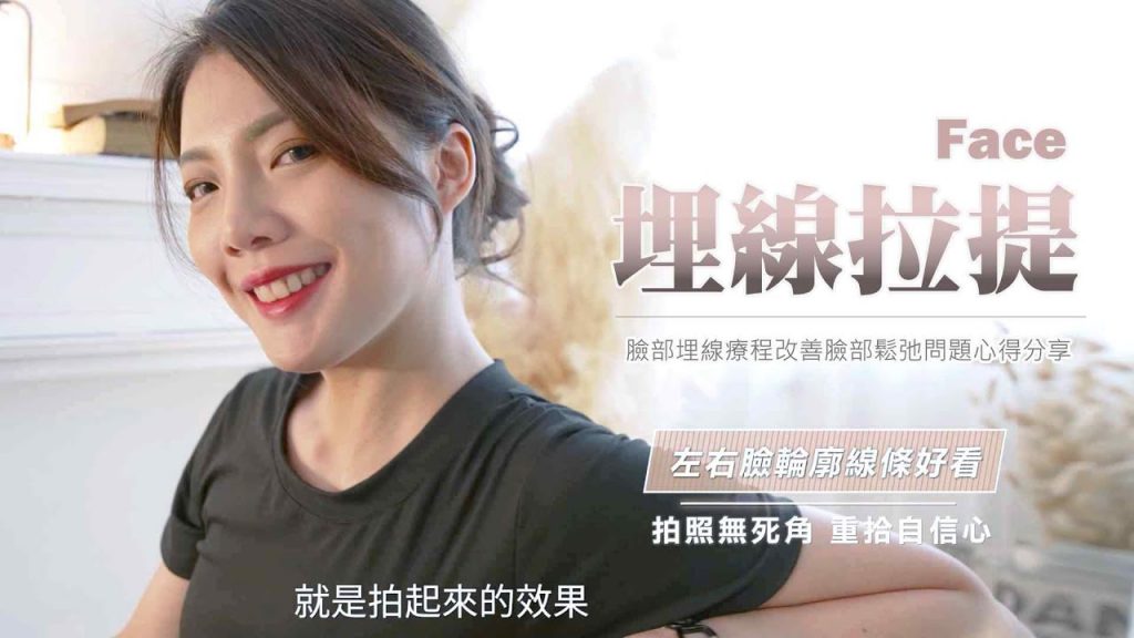 臉部埋線療程改善臉部鬆弛問題心得分享,臉部埋線真的可以讓臉變緊實嗎?