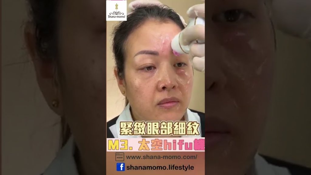 太空Hifu機‼ ️‼ ️‼ ️ 特強收緊