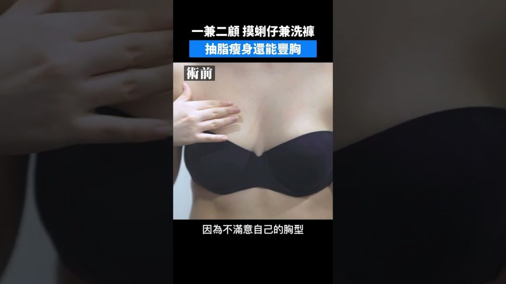自體脂肪隆乳抽脂同時豐胸一兼二顧 ~