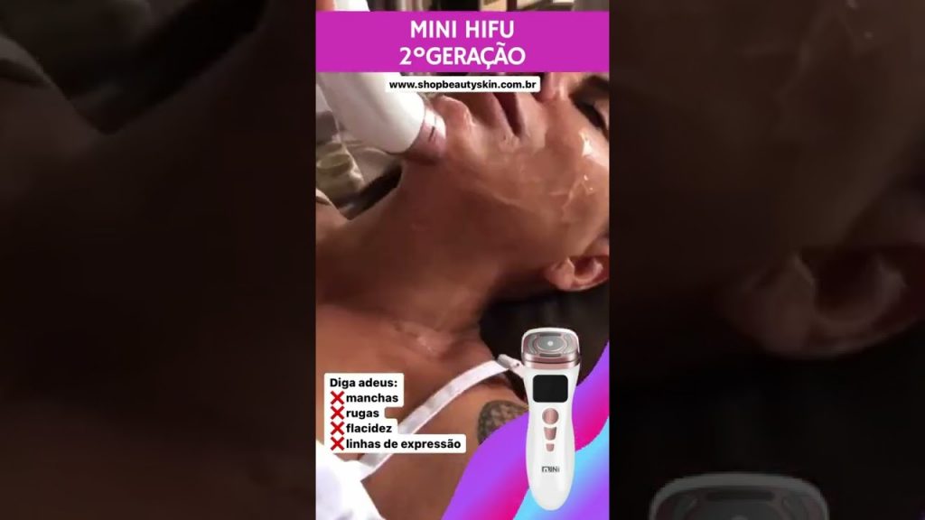 MINI HIFU 2ºGeração – SHOP BEAUTY SKIN