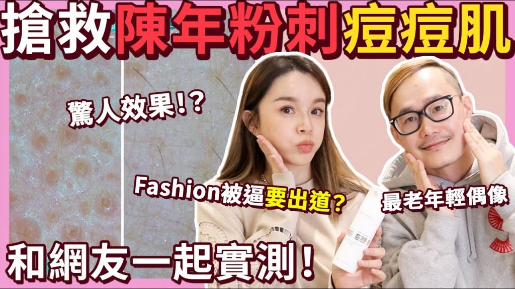 網友一起實測! 醫美級面膜搶救陳年頑固粉刺痘痘肌…