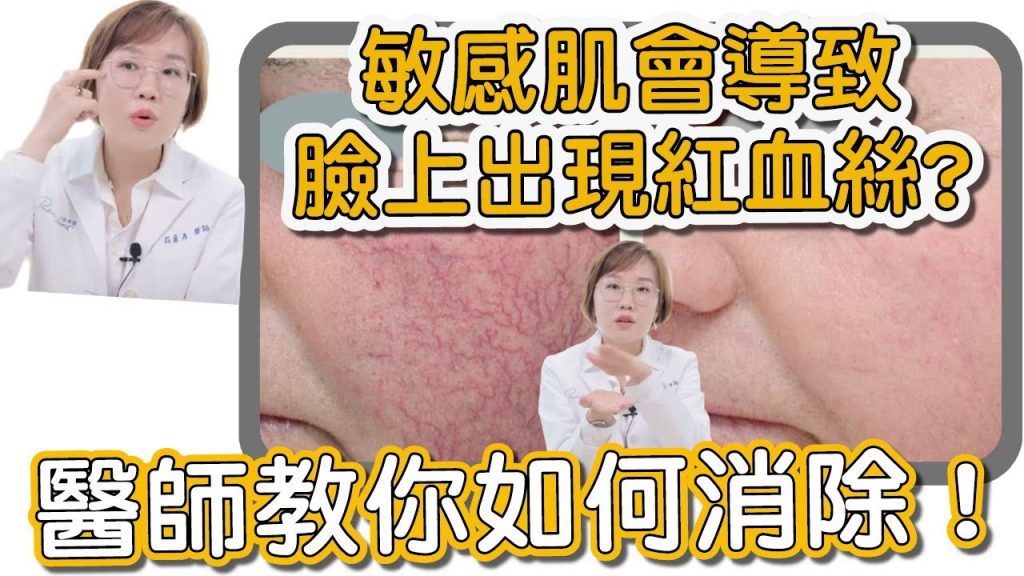 臉上出現紅血絲就代表皮膚薄、敏感?讓你臉上紅血管明顯的原因是這些!