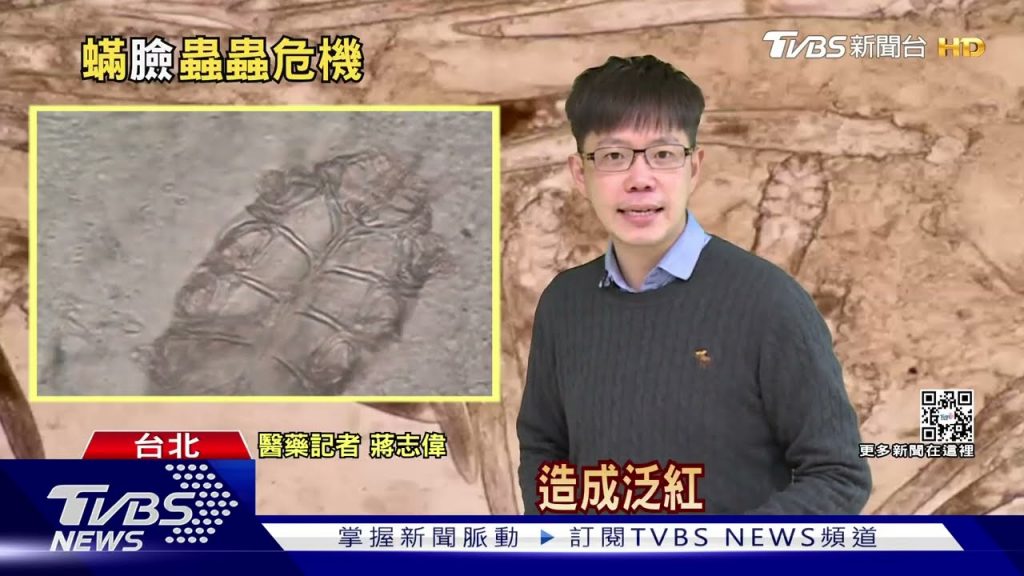 臉部出現「這幾個」症狀毛囊藏「蠕形蟎蟲」啃皮脂致發炎|十點不一樣20221229 @TVBSNEWS01