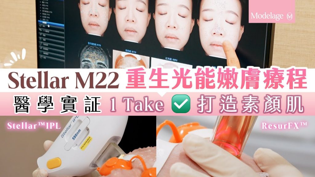 【光子嫩膚】公開全新正廠Stellar M22 最佳濾鏡治療組合|光能美白去斑收細毛孔|極速改善荳印|撫平凹凸洞| 有字幕2023 | 資料來源Modelage HK 2023