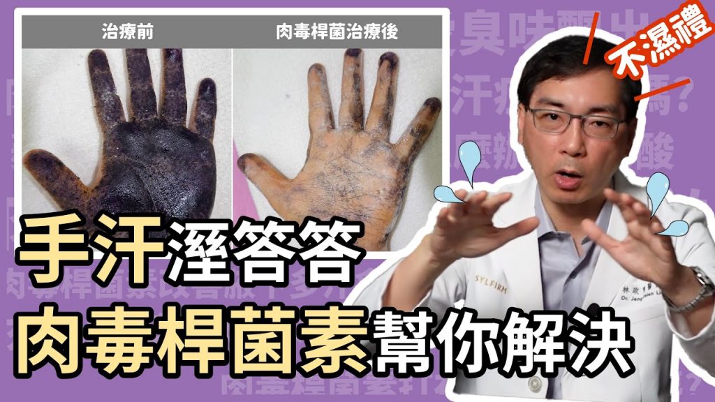 手汗症有沒有安全、有效的治療方法?如何治療才不會有代償性出汗?就讓皮膚科林政賢醫師來跟大家介紹肉毒桿菌素治療手汗症吧!