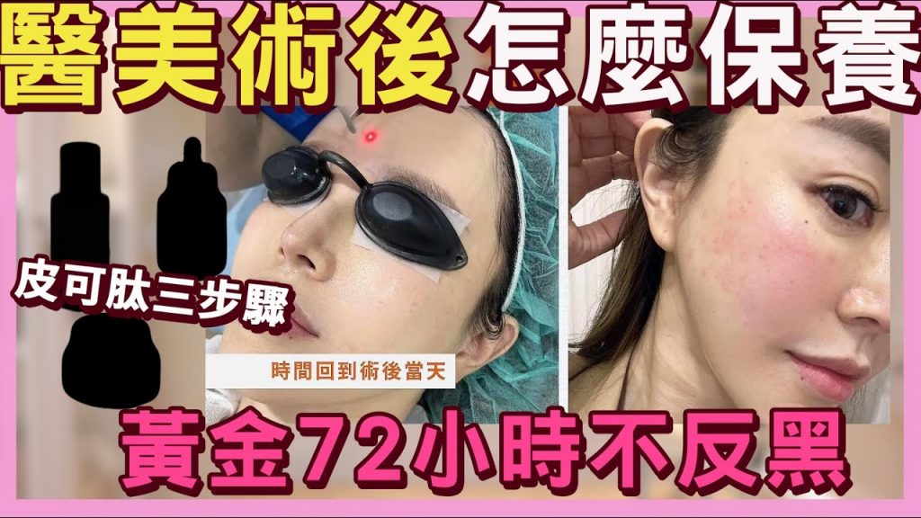 醫美術後該怎麼保養😱你不知道的不反黑/縮短修復期的方法….