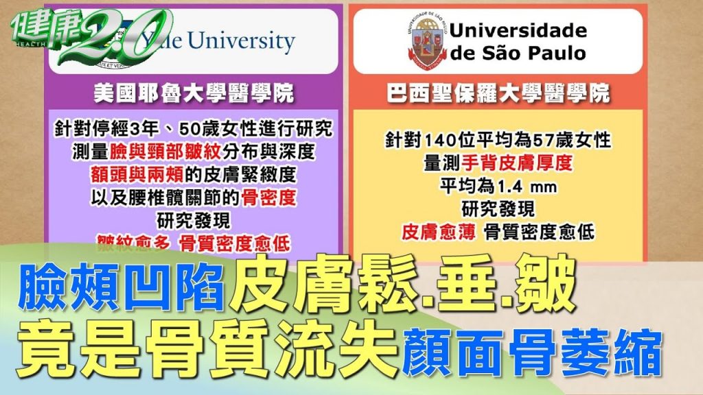 臉頰凹陷皮膚鬆、垂、皺竟是骨質流失顏面骨萎縮健康2.0