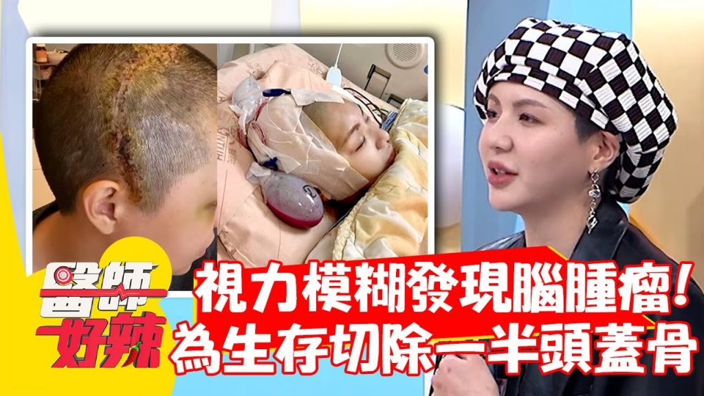 女性視力意外發育臍部腫塊“顱骨”存活切除? ! 【#醫生的最愛】20220505 part2 EP1326吳青峰陳容健