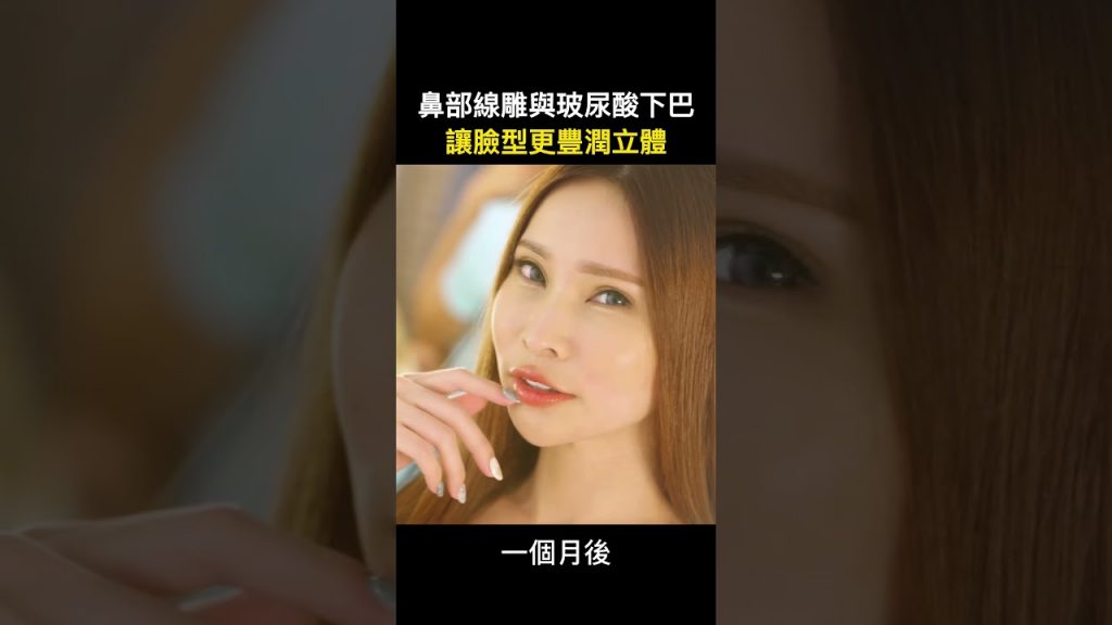 微笑唇玻尿酸與臉部埋線拉皮心得分享